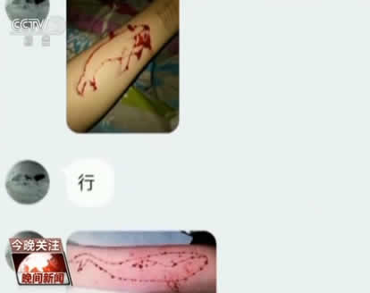 危险自杀游戏教唆少年自残自杀 警方及时救助